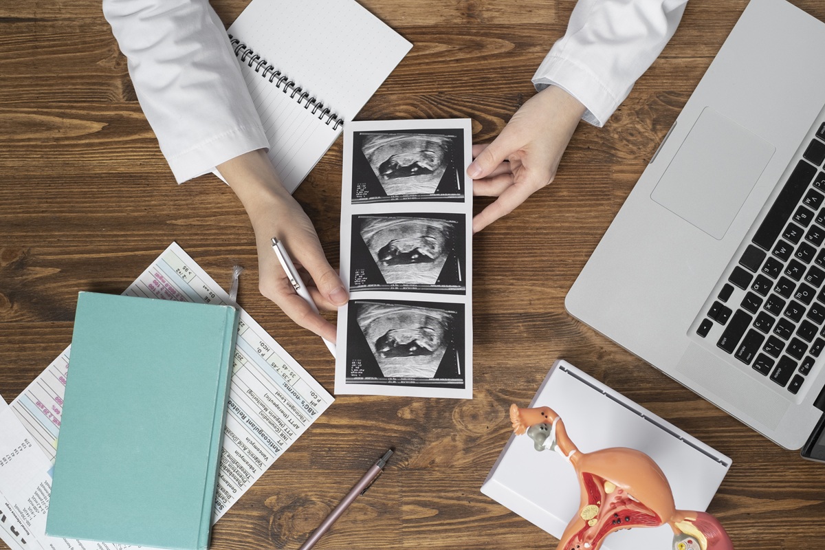 Procréation Médicalement Assistée (PMA)